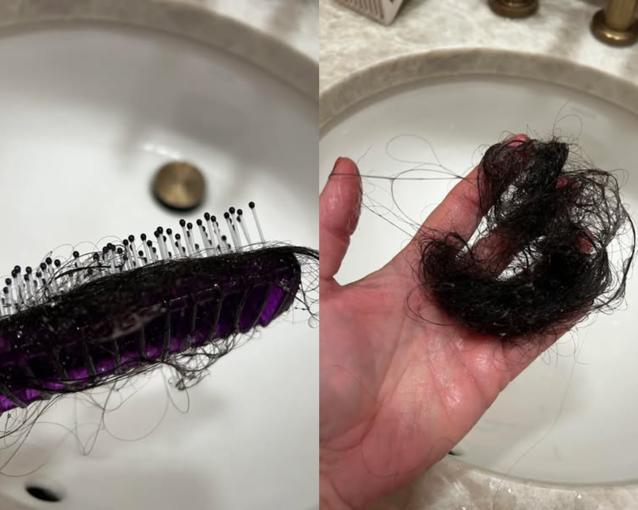 Hair loss — hairbrush and hand holding loose strands